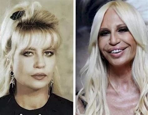 versace new face|donatella Versace face what happened.